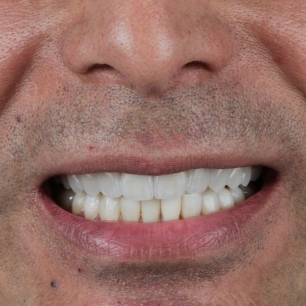 Caso clínico con el Dr. Sahid 5